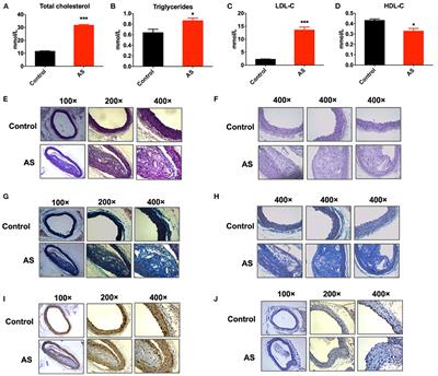 Differentially Expressed Circular Non-coding RNAs in Atherosclerotic Aortic Vessels and Their Potential Functions in Endothelial Injury